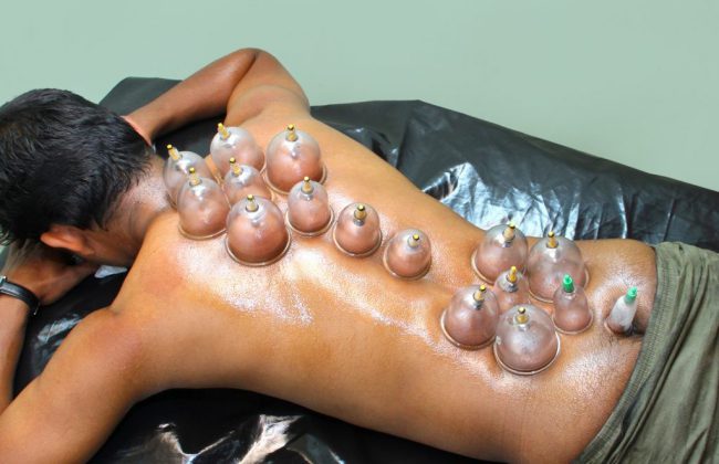 Hijama-therapy in Delhi